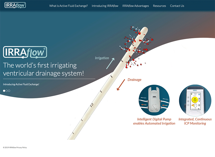 Stereotactic placement of dual lumen catheter systemfor continuous ...