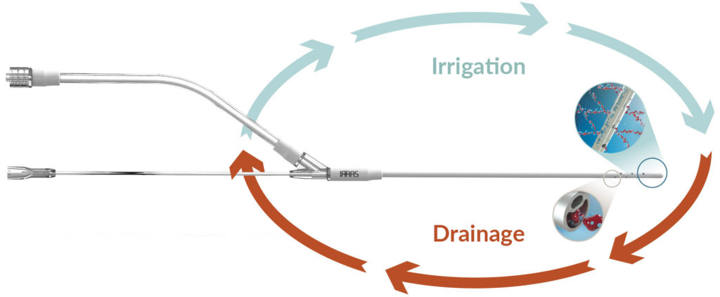 Irrigation-Aspiration2